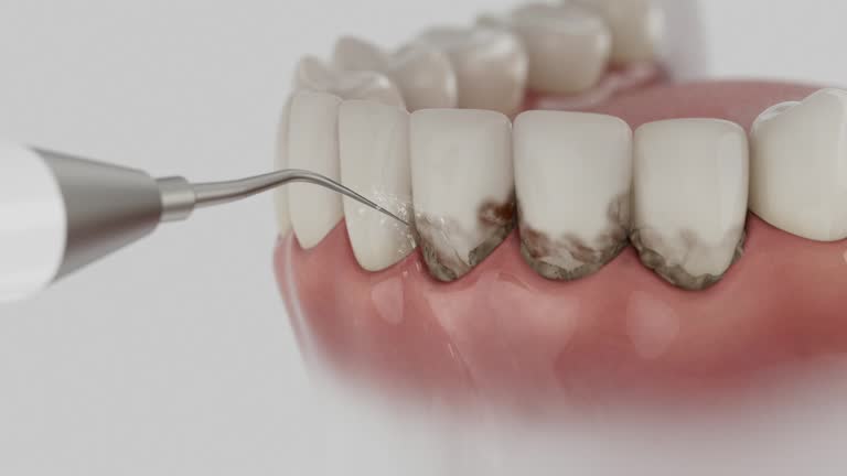 Reliable Dental contractor in Huntingburg, IN by Dentist Open Now